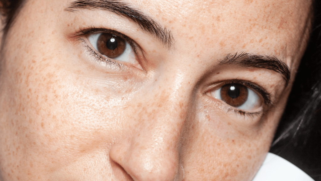 Sensitive Dry Skin