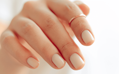 Vertical Split Nail: Causes, Prevention, and Treatment