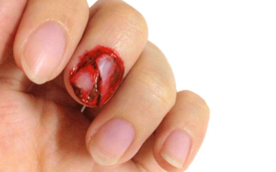 Acrylic Nail Ripped Off Real Nail: The Painful Experience