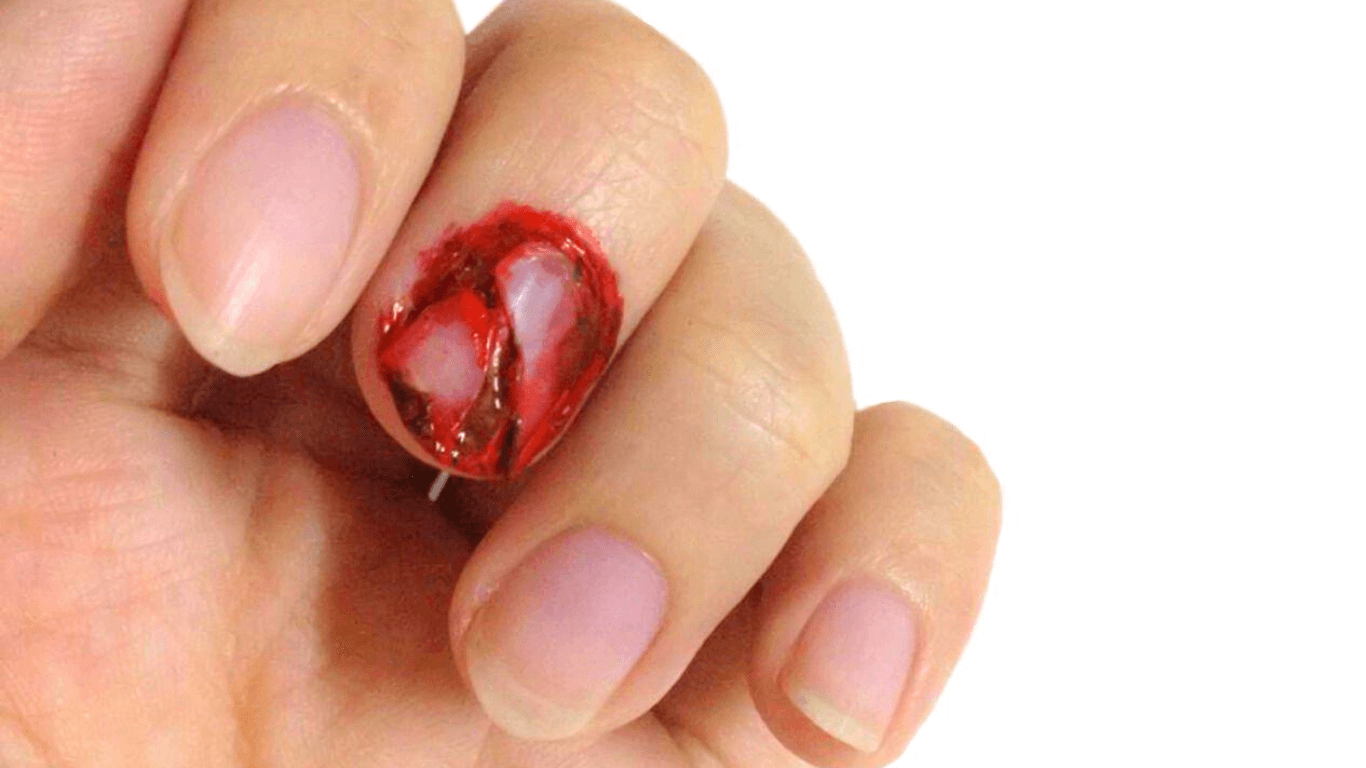 Acrylic Nail Ripped Off Real Nail: The Painful Experience