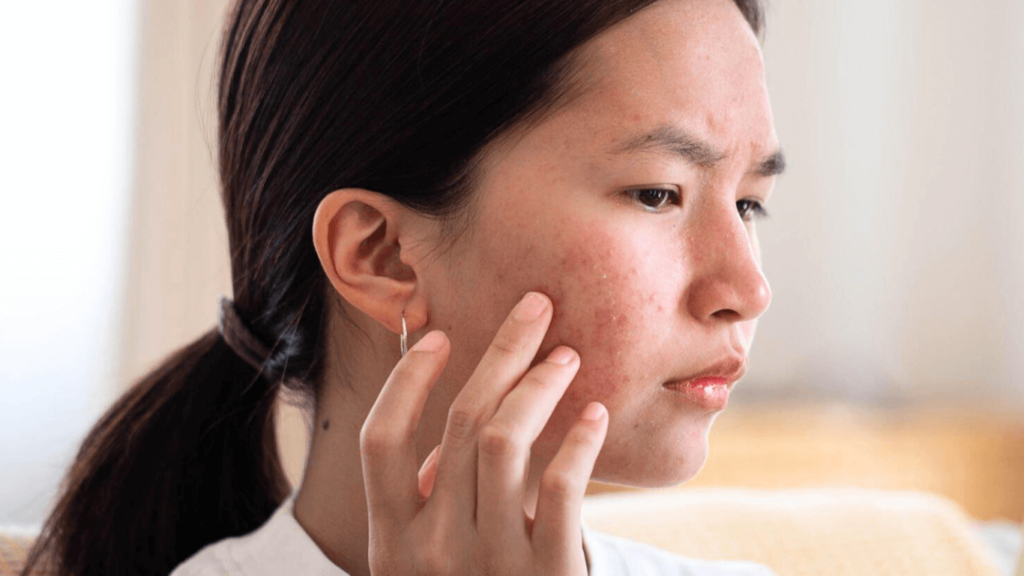 Cover Scars with Makeup