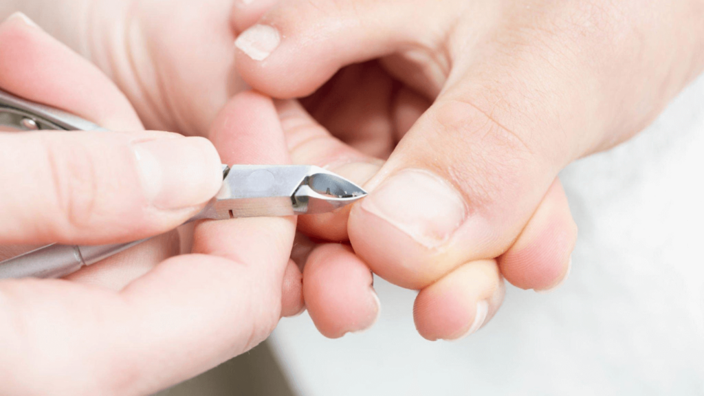 Cuticle of Nail