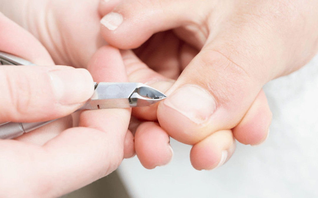 Unraveling the Beauty and Importance of the Cuticle of Nail