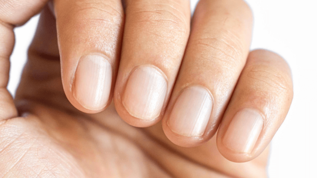 Nails Cut Too Short