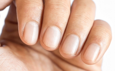 Nails Cut Too Short: Understanding the Causes & Remedies
