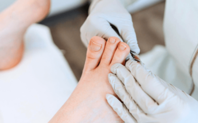 Toe Nail Doctor: Expert Care for Healthy and Beautiful Toenails