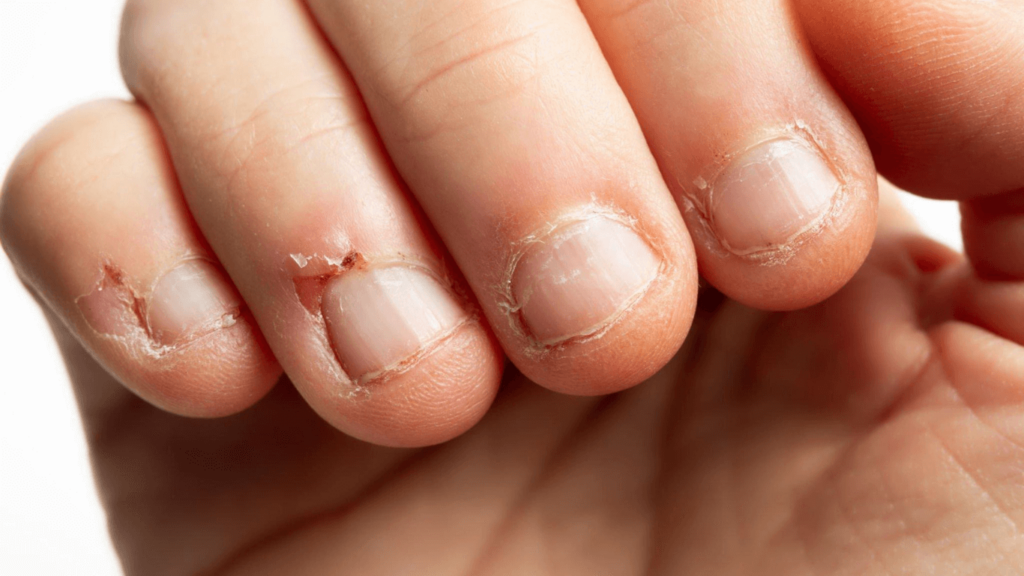Why Do My Nails Hurt After Getting Them Done?