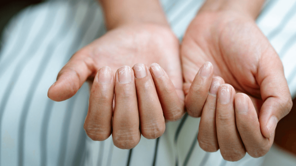 Nail Remedies