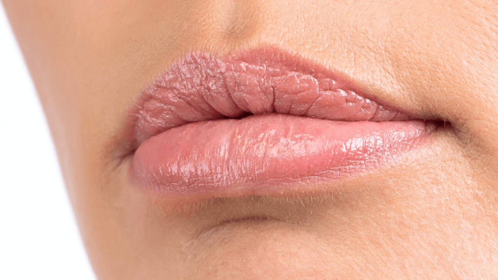 Can Lip Plumpers Cause Cold Sores?