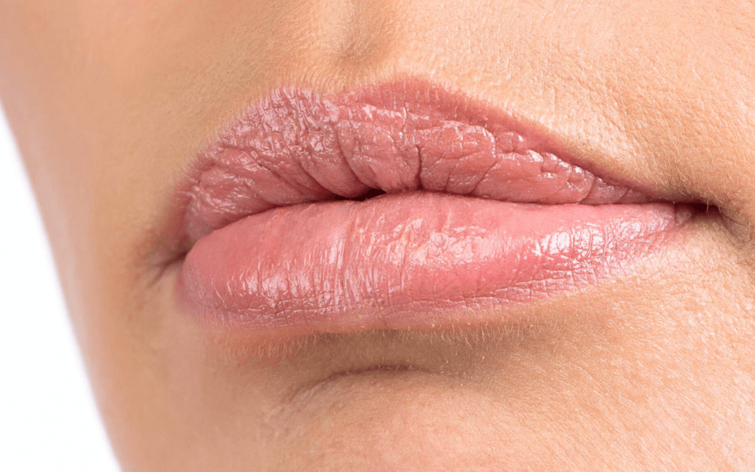 Can Lip Plumpers Cause Cold Sores?