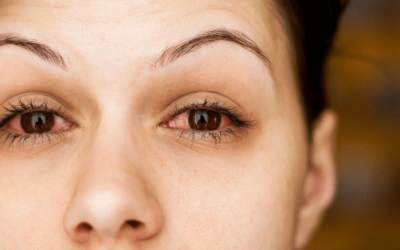 Unveiling the Truth: Can Makeup Cause Pink Eye?