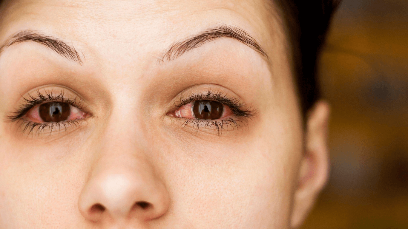 Can Makeup Cause Pink Eye?