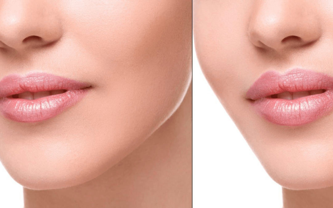 The Mystery: Does Lip Plumper Work Long Term?