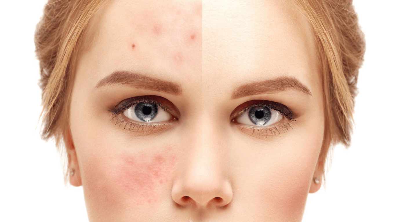 How to Prevent Skin Damage from Makeup