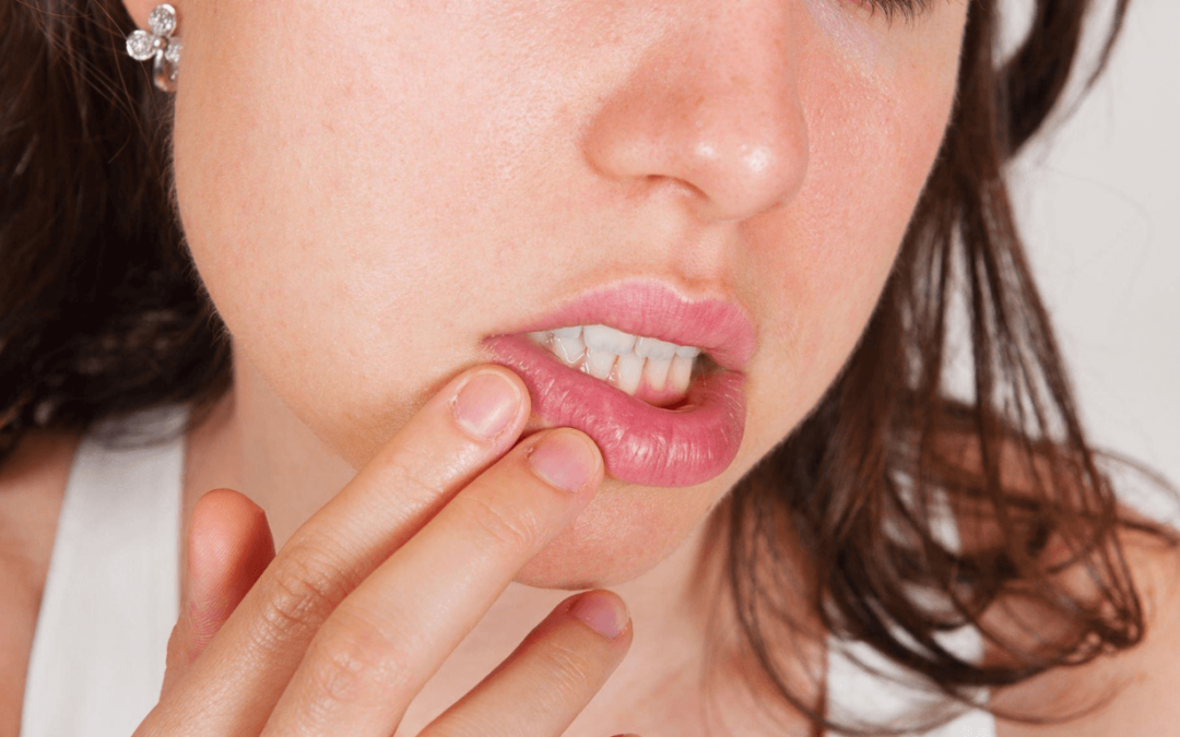 Hyaluronic Acid in Lip Balms: A Deep Dive into the Ultimate Lip Care