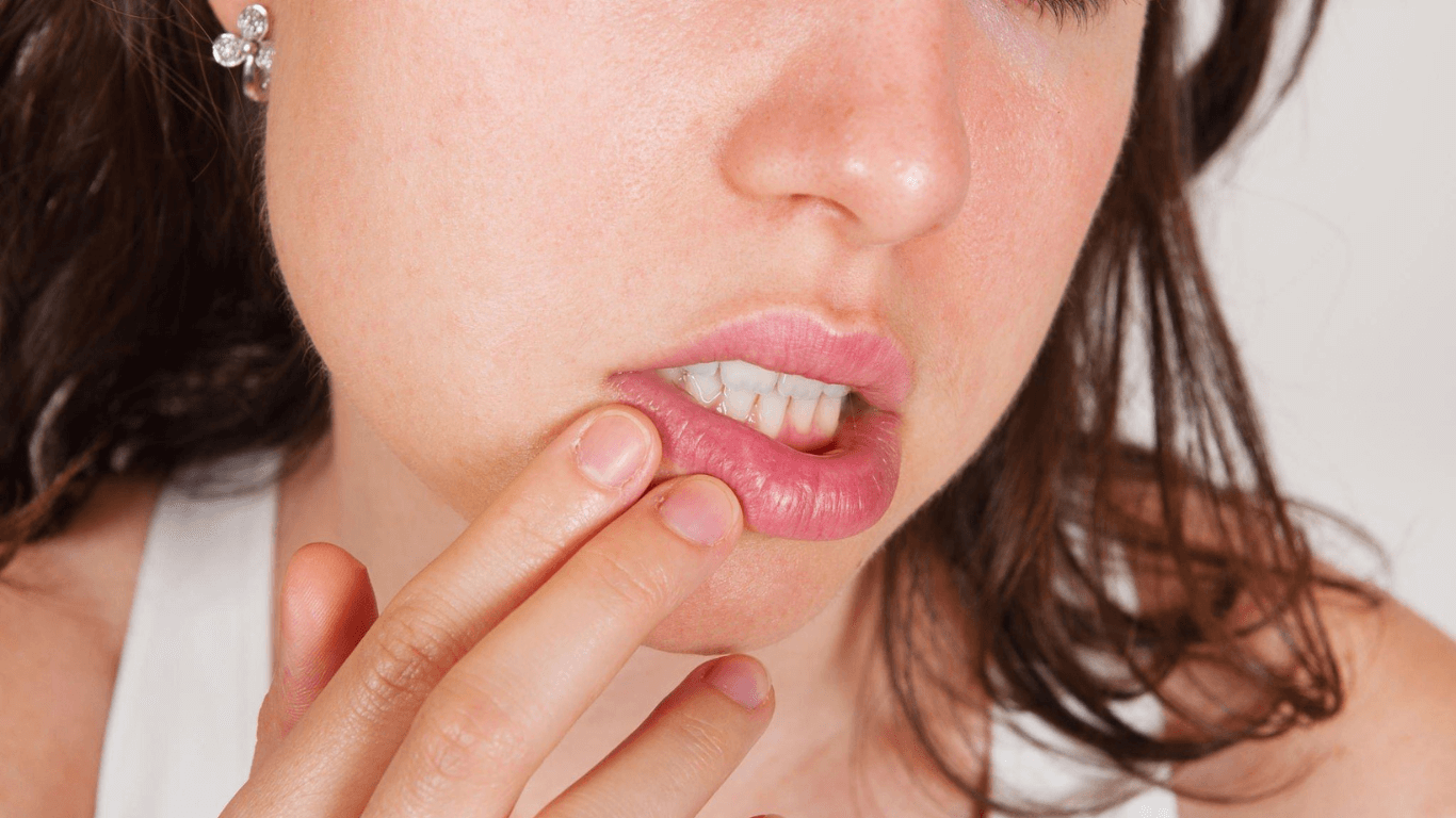 Hyaluronic Acid in Lip Balms
