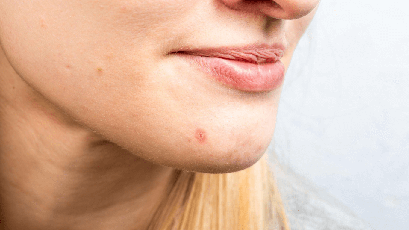 Lip Balm with Color The Fusion of Nourishment and Style