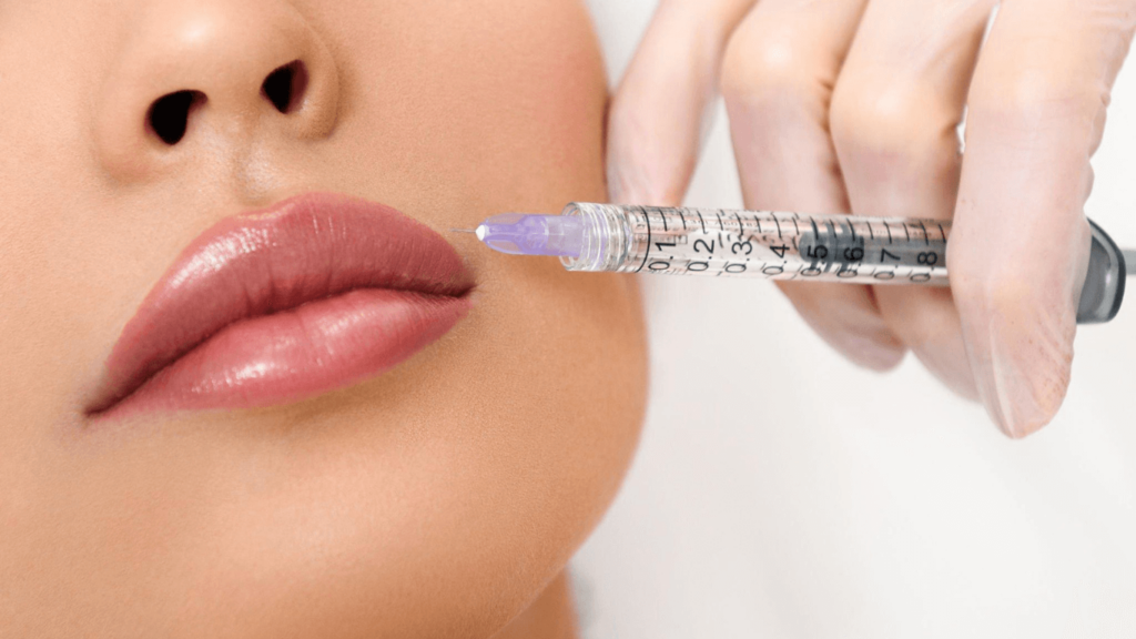 Plump Lips Without Injections