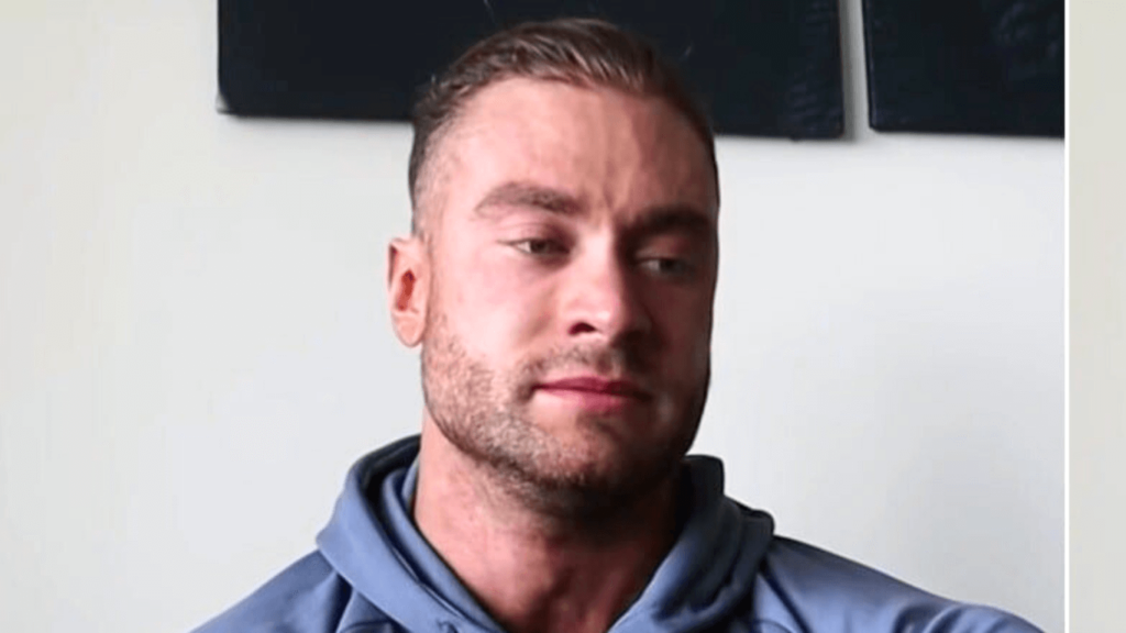 Chris Bumstead Hair Loss