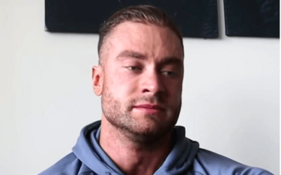 Chris Bumstead Hair Loss: Bodybuilding Icon’s Solutions