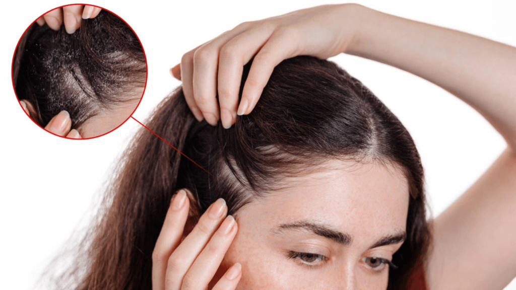 Garnier Hair Loss Lawsuit