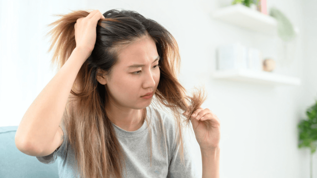 Lamictal Hair Loss