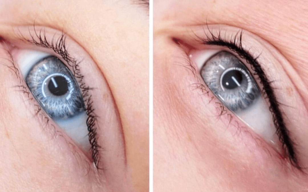 Transforming Beauty: Tattooed Eyeliner Before and After