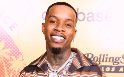 Tory Lanez Hair Loss – Causes, Impact, and Solutions